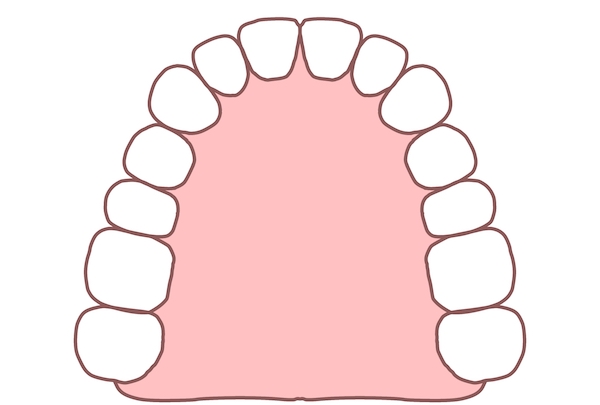 その他、歯並びでお悩みの方